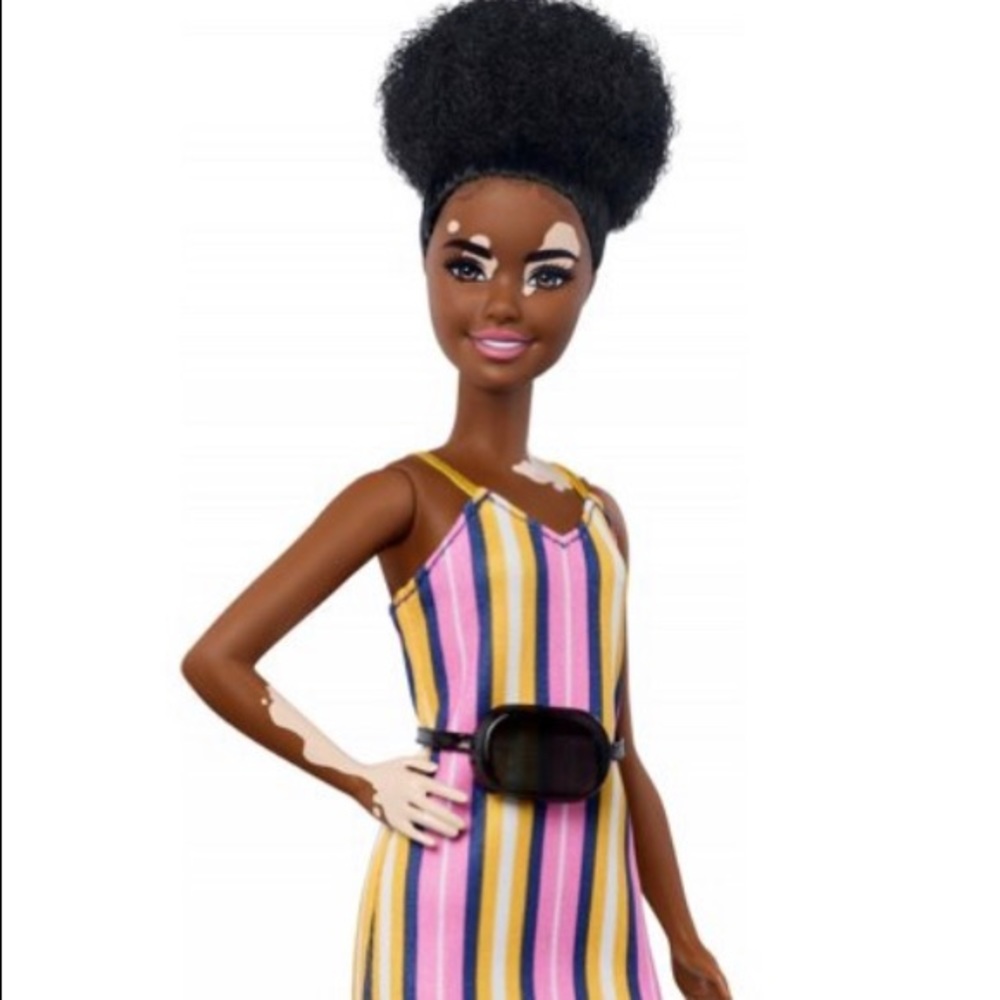 Barbie Fashionistas Doll #135 With Vitiligo